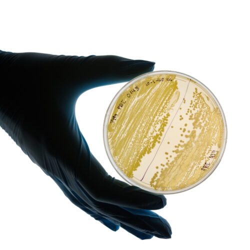 A hand wearing a blue latex glove holds a petri dish growing bacteria